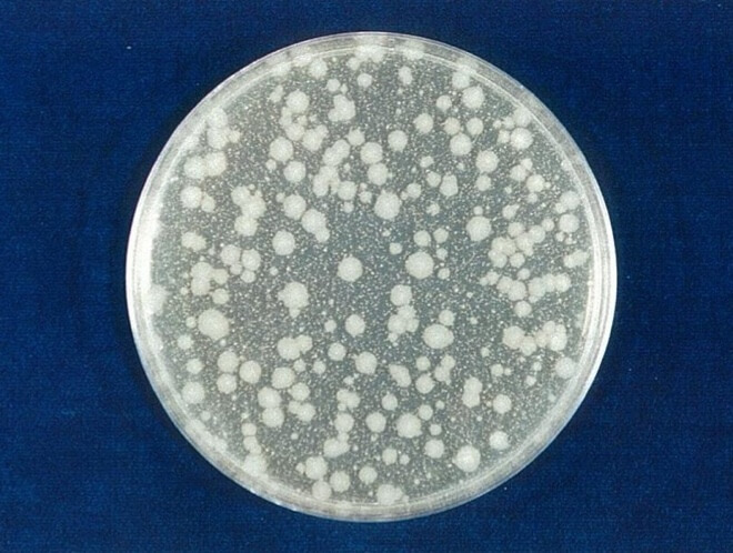 大腸菌 開始時（共通写真）