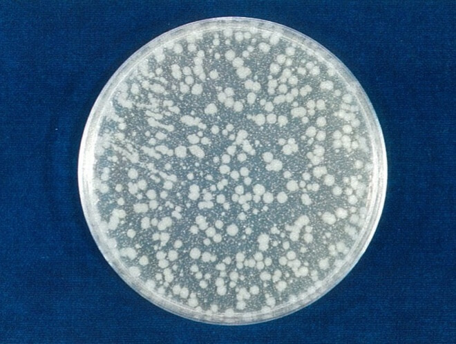 大腸菌 対照 4時間後（写真-3）