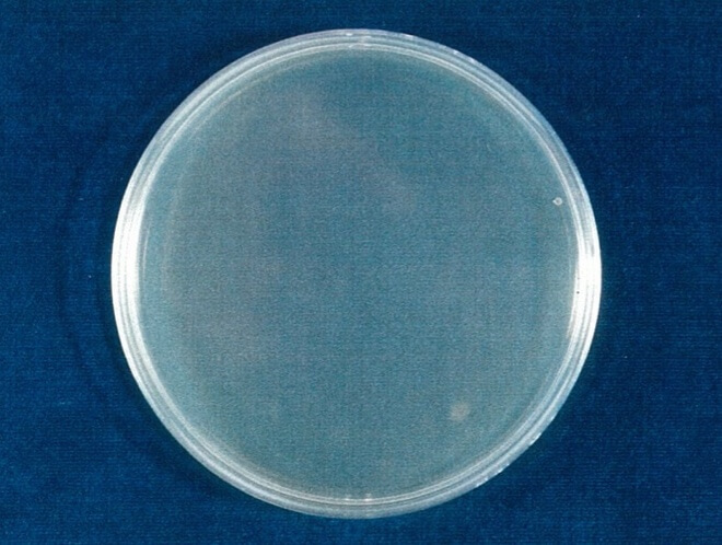 大腸菌 検体 24時間後（写真-4）