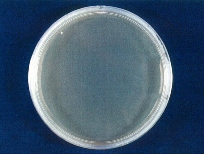 大腸菌（O157:H7） 検体 24時間後（写真-4）