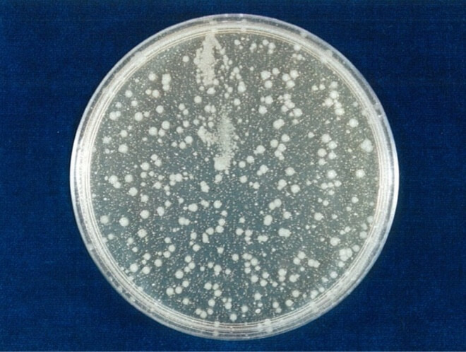 大腸菌（O157:H7） 開始時（共通写真）
