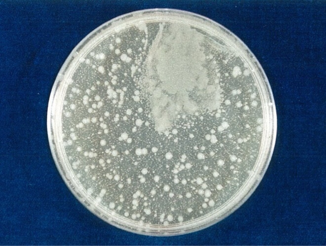 大腸菌（O157:H7） 対照 4時間後（写真-3）