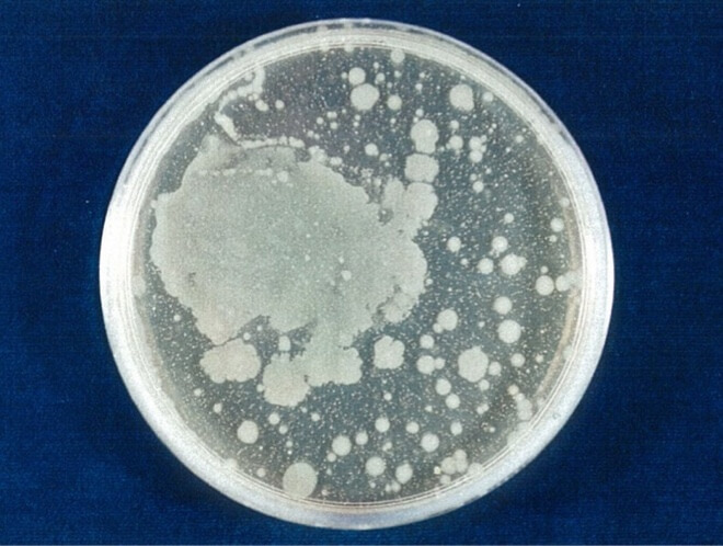 大腸菌（O157:H7） 対照 24時間後（写真-5）