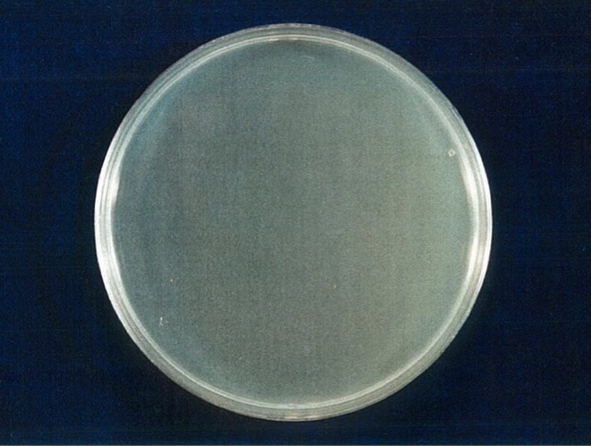 アオカビ 検体 24時間後（写真-4）