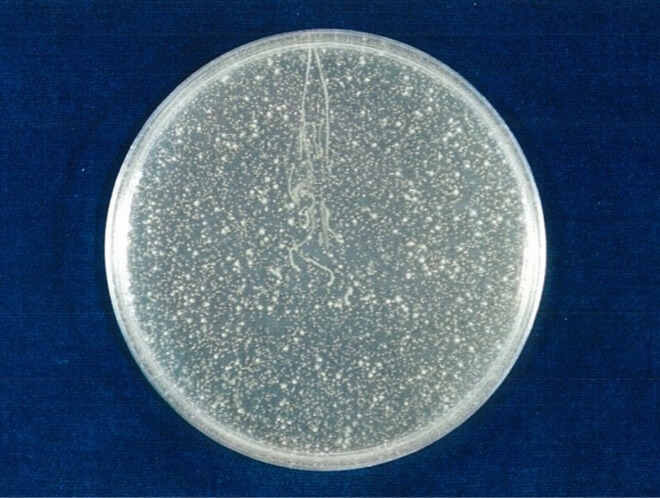 黄色ブドウ球菌 開始時（共通写真）