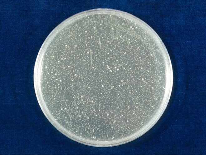 黄色ブドウ球菌 対照 24時間後（写真-5）