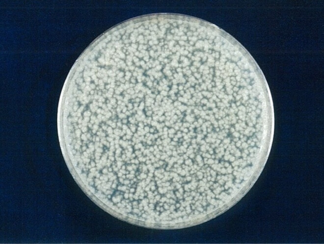 クロカワカビ 対照 24時間後（写真-5）