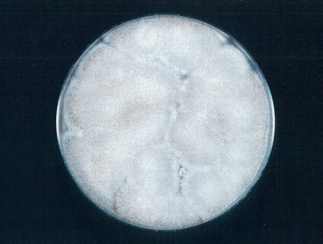 クロコウジカビ 検体 4時間後（写真-2）