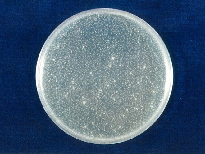 MRSA 開始時（共通写真）