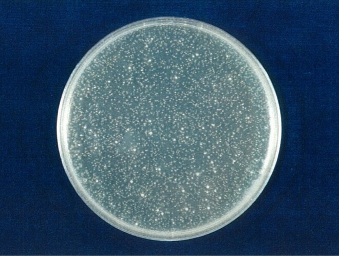 MRSA 対照 4時間後（写真-3）