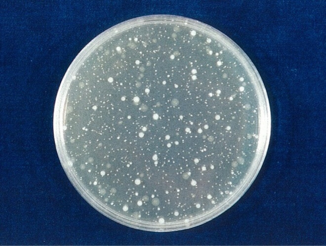 MRSA 対照 24時間後（写真-5）