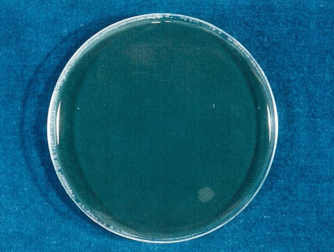 レジオネラ 検体 4時間後（写真-2）