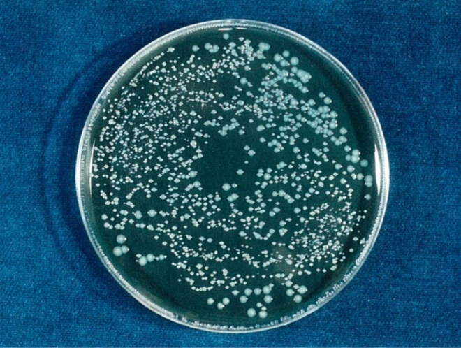 レジオネラ 開始時（共通写真）