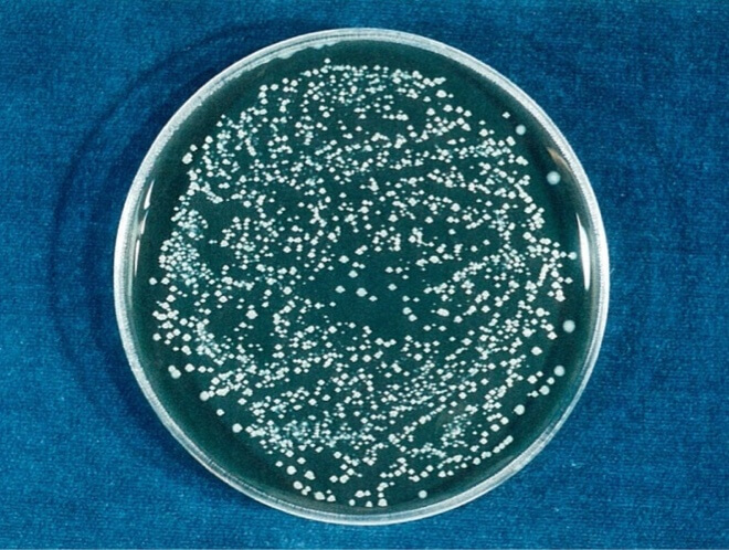 レジオネラ 対照 24時間後（写真-5）