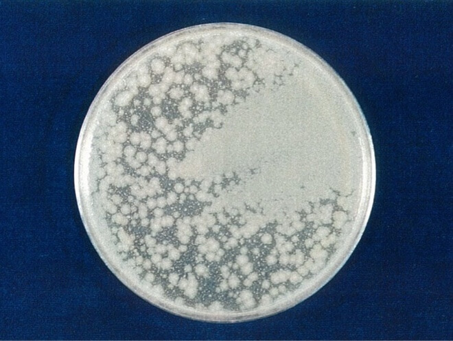 緑膿菌 対照 4時間後（写真-3）