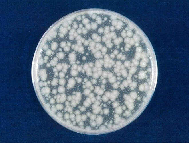 緑膿菌 対照 24時間後（写真-5）